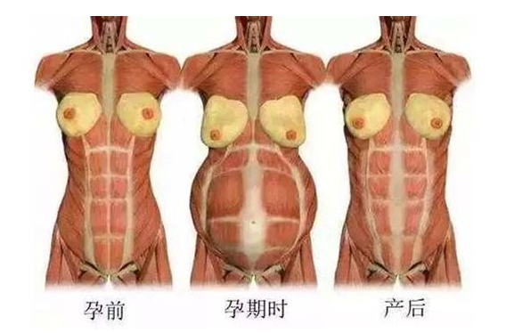 產(chǎn)后媽媽骨盆修復(fù)――帶你回到完美身材！