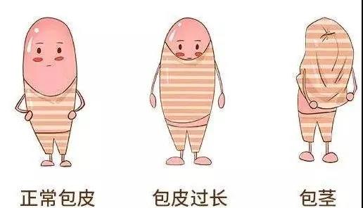【保山安利醫(yī)院】家長速看！暑期包皮手術(shù)預(yù)約正當(dāng)時！