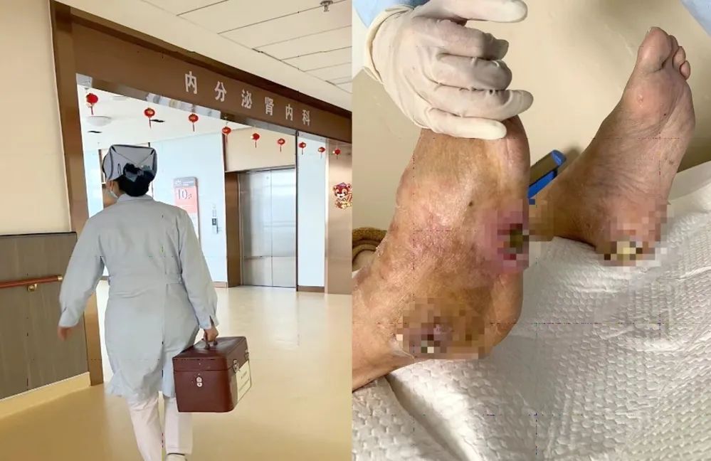 【保山安利醫(yī)院】傷口治療一站式，健康生活零距離！